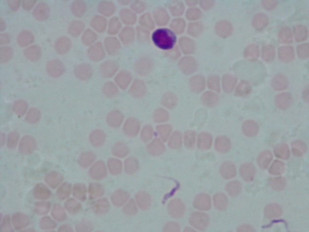 Trypanosoma Slides - Trypanosoma 07 400X